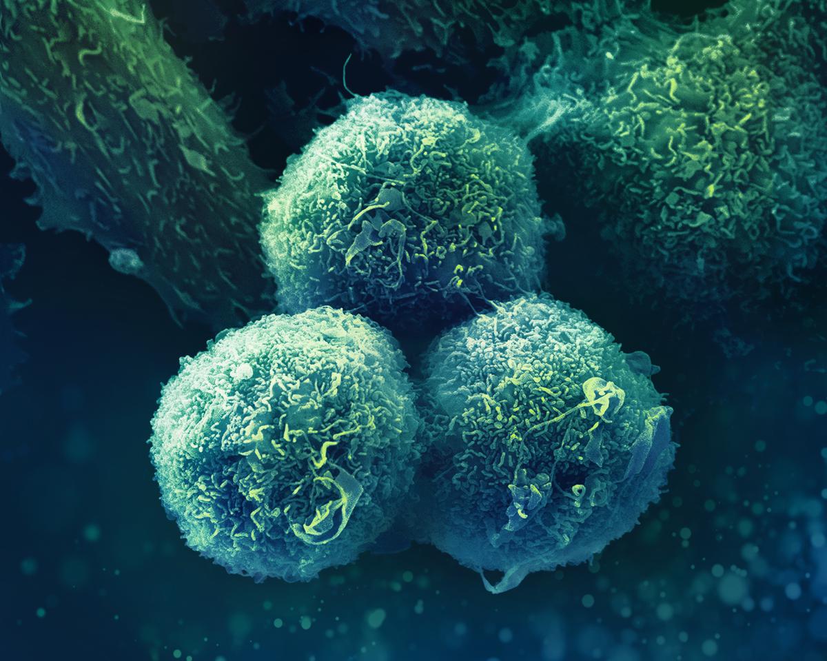 I MSD arbejder vi for en verden, hvor kræft ikke alene behandles, men kureres.